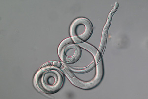 Strongyloides spp magnified