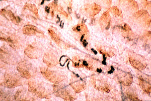 A parasitic female in rat gut